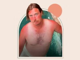 Sunburnt man in front of pool